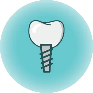 Dental implants